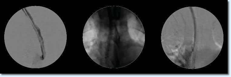 Fibrex Radiology